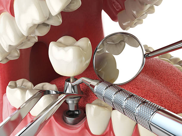 Best Emergency Treatment for Toothache in Seneca, KS